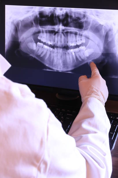 Best Emergency Broken Tooth Repair in Sanford, FL